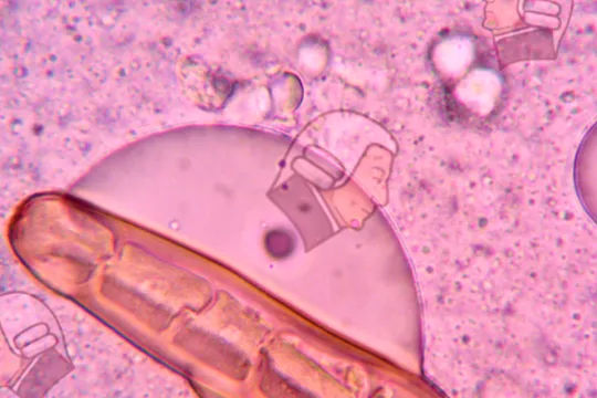 bacteriadam smith 2