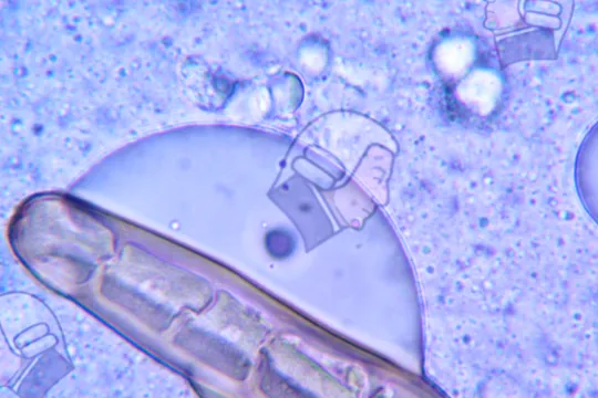 Bacteriadam Smith 3
