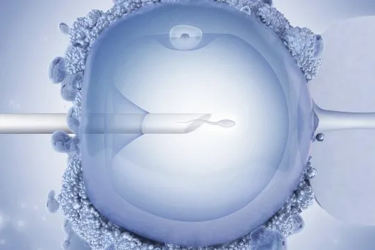 IVF