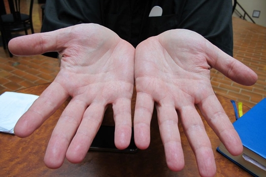 Handen van Martin (Foto Damien Spleeters)