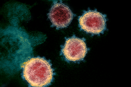 Coronavirus (Sars-CoV-2) gezien door elektronenmicroscoop (Foto (CC) NIAID-RML)
