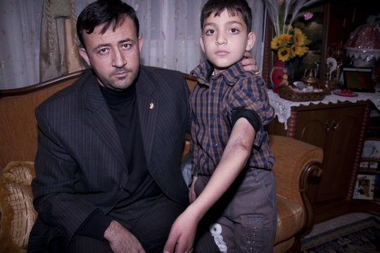 Dokter Raed met zijn zoon Abed. Het linkerhand van de jongen is zo goed als gevoelloos. (Foto Benoit De Freine)